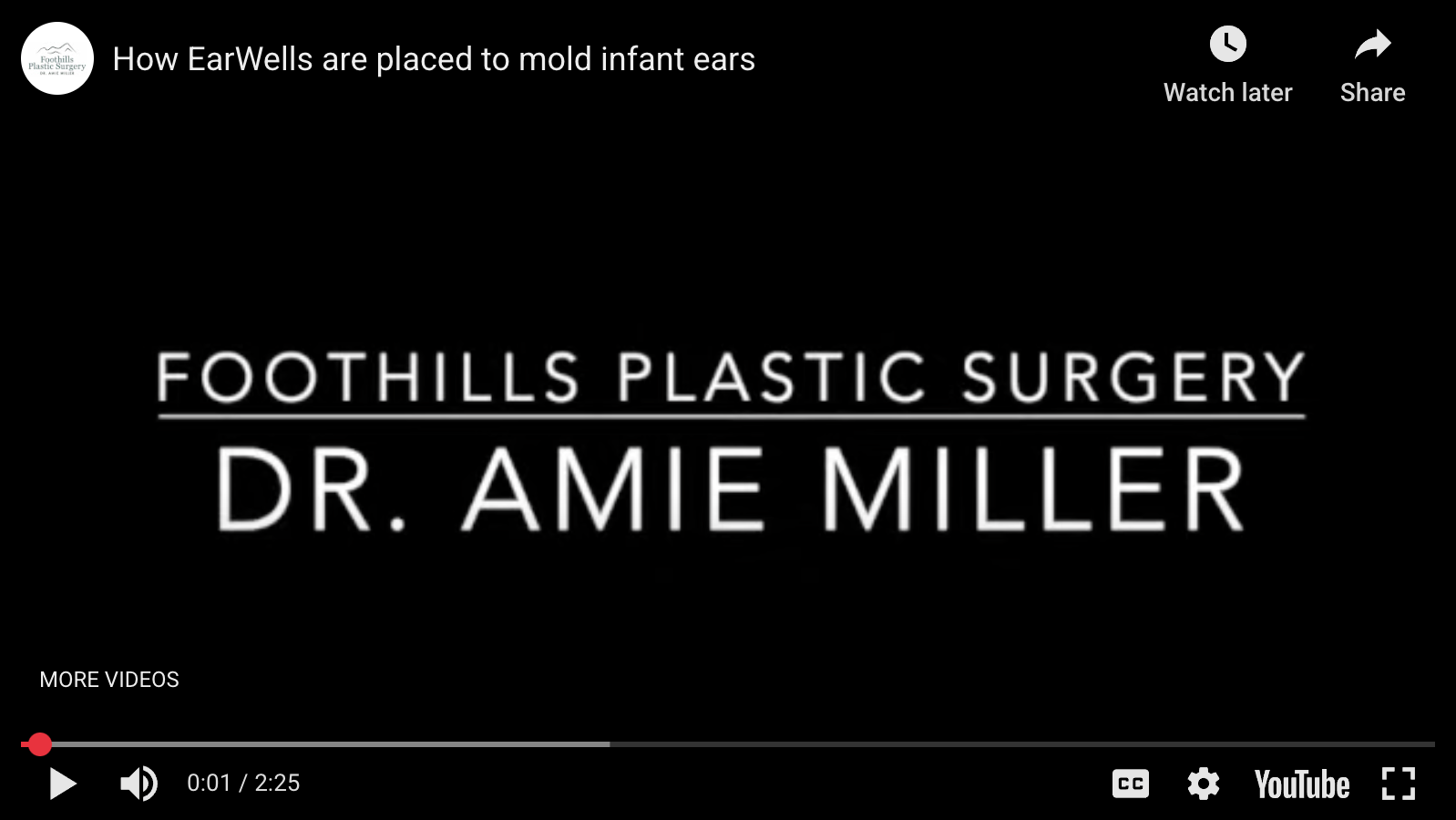 EarWell Device for Infant Ear Molding