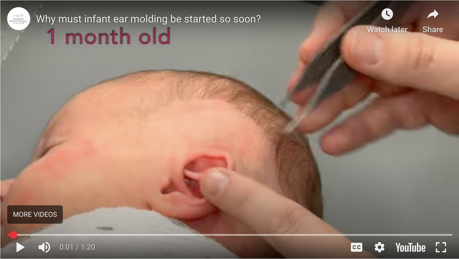 Is My Child a Candidate for the EarWell System?