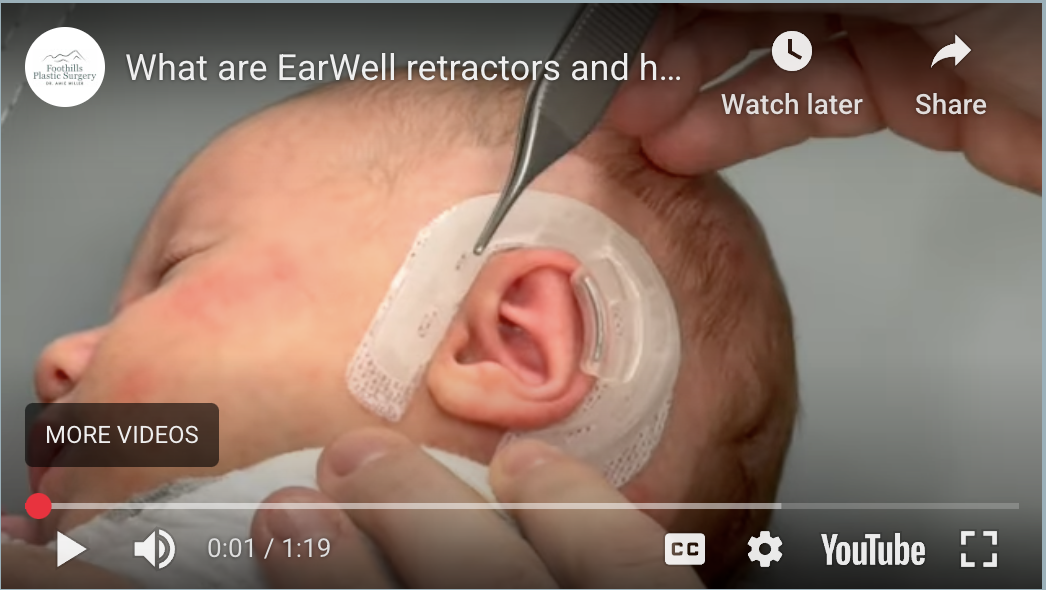 What Does the EarWell Treatment Process Involve?